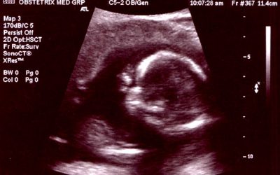 Pioneer of Obstetric Ultrasound: Sir Ian Donald